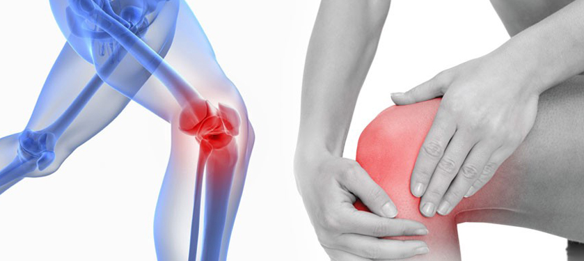 Joint Replacement Surgery