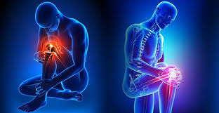 Joint Replacement Surgery